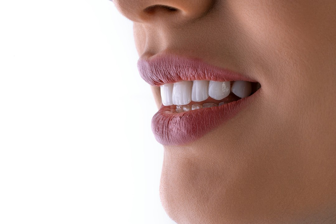 Bright healthy teeth comparison for whitening treatments
